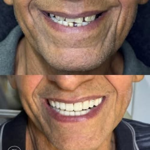 oralmed.odonto_654579447_18097308938510862_2931289708480964088_n