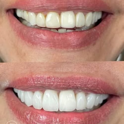 oralmed.odonto_659016081_18098303984510862_2674659193688945904_n