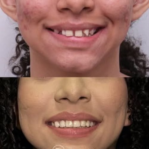 oralmed.odonto_739919994_18111762914510862_319013323366520661_n