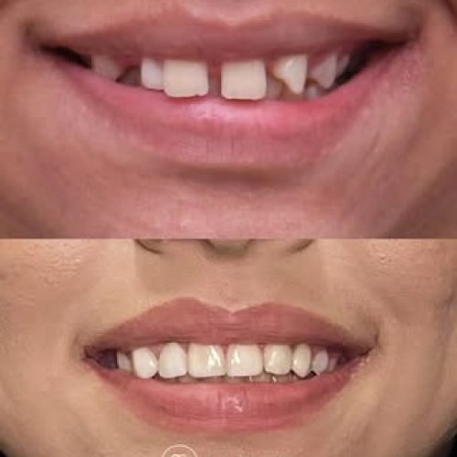 oralmed.odonto_740425541_18111762887510862_5544030398959091094_n