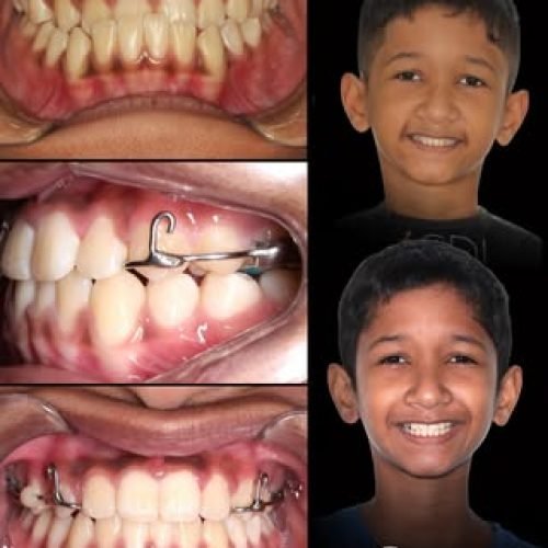oralmed.odonto_772305904_18116880983510862_1061500899410458843_n